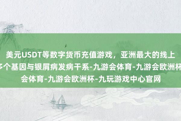 美元USDT等数字货币充值游戏，亚洲最大的线上游戏服务器供应商多个基因与银屑病发病干系-九游会体育-九游会欧洲杯-九玩游戏中心官网